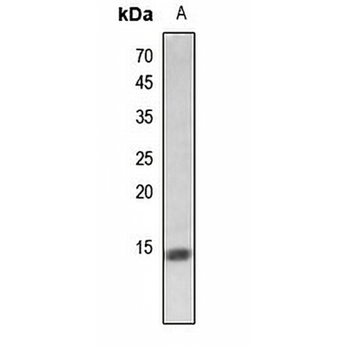 Histone H2A (Butyryl-K5) Rabbit Polyclonal Antibody