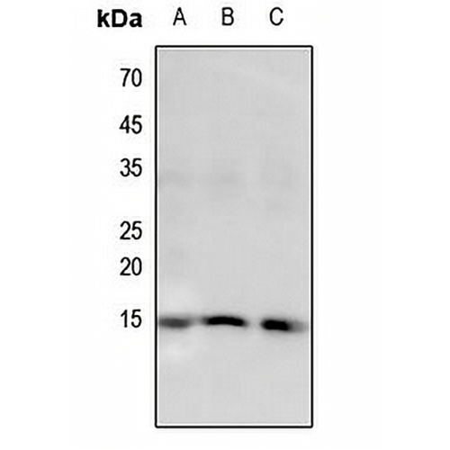 Histone H2B (Butyryl-K5) Rabbit Polyclonal Antibody