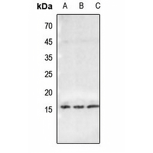 Histone H2B (Butyryl-K23) Rabbit Polyclonal Antibody