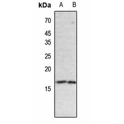 Histone H3 (Butyryl-K18) Rabbit Polyclonal Antibody