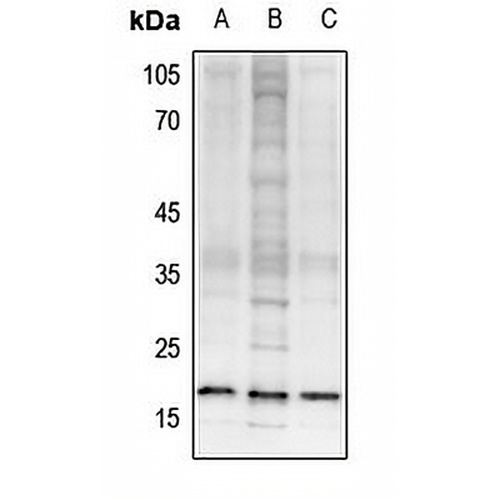 Histone H3 (TriMethyl-K27) Rabbit Polyclonal Antibody