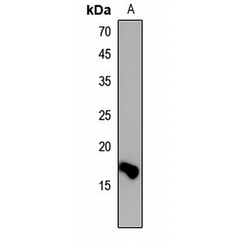 Histone H3 (DiMethyl-K36) Rabbit Polyclonal Antibody