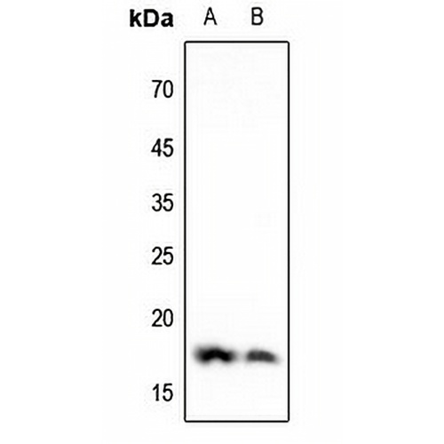 Histone H3 (DiMethyl-K4) Rabbit Polyclonal Antibody