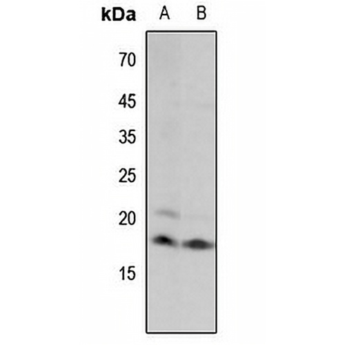 Histone H3 (MonoMethyl-K18) Rabbit Polyclonal Antibody