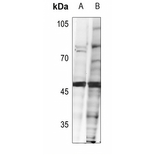 FOXH1 Rabbit Polyclonal Antibody