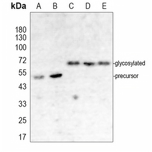 PAR1 Rabbit Polyclonal Antibody