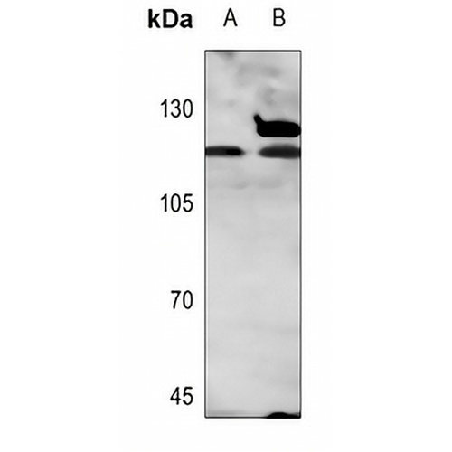 Androgen Receptor Rabbit Polyclonal Antibody