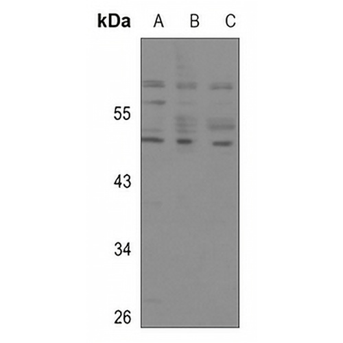 p53 Rabbit Polyclonal Antibody