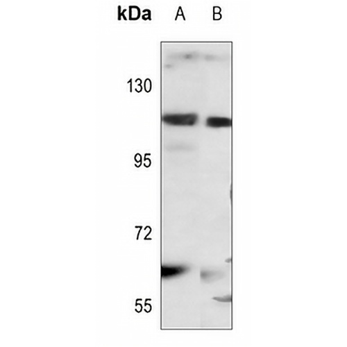 STAT2 Rabbit Polyclonal Antibody