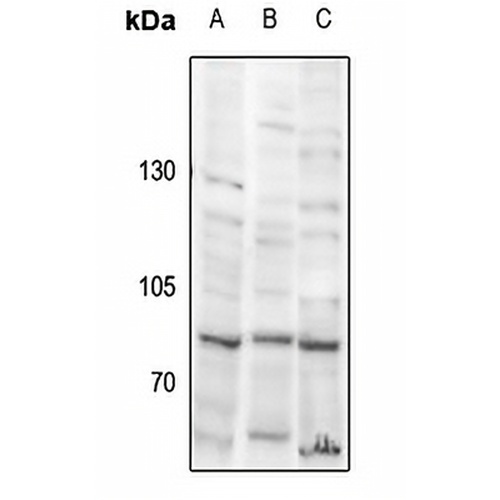 USP51 Rabbit Polyclonal Antibody