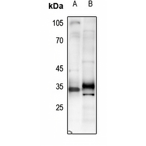 Adiponectin Rabbit Polyclonal Antibody