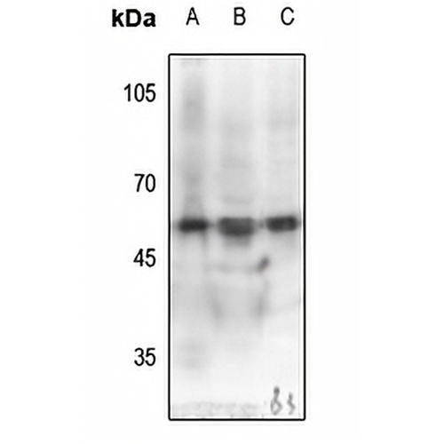 MEF2C (Phospho-S387) Rabbit Polyclonal Antibody