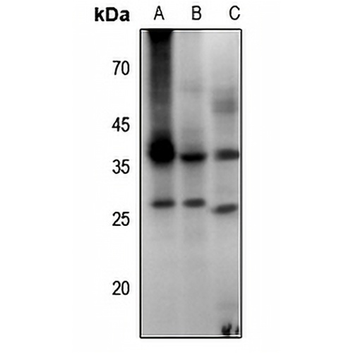 Aquaporin 2 (Phospho-S256) Rabbit Polyclonal Antibody