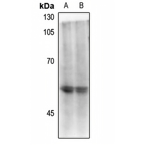 CD4 (Phospho-S433) Rabbit Polyclonal Antibody