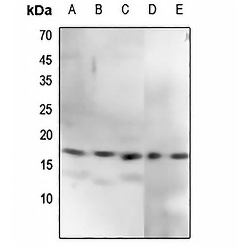 CENPA (Phospho-S7) Rabbit Polyclonal Antibody