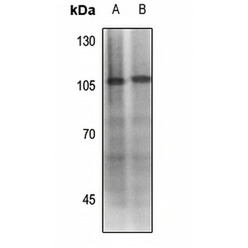 MDM2 (Phospho-S186/S188) Rabbit Polyclonal Antibody