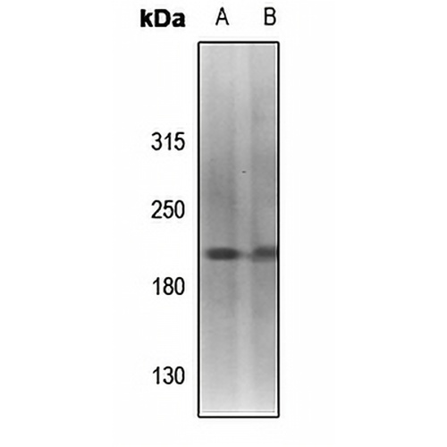 Topoisomerase 2 alpha (Phospho-S1213) Rabbit Polyclonal Antibody