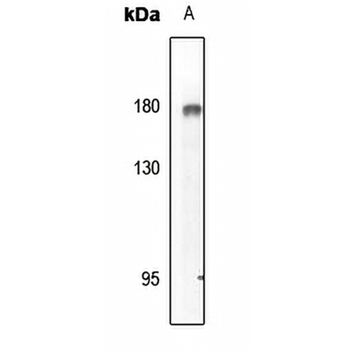 EGFR (Phospho-Y869) Rabbit Polyclonal Antibody