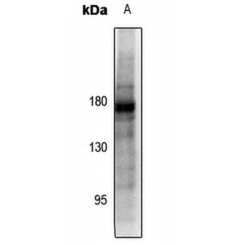 PDGFR beta (Phospho-Y857) Rabbit Polyclonal Antibody