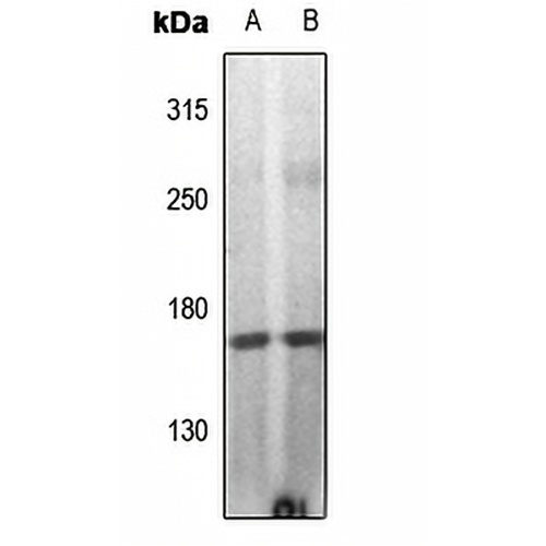 DAP Kinase 1 (Phospho-S308) Rabbit Polyclonal Antibody