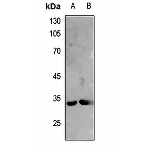 DARPP32 Rabbit Polyclonal Antibody