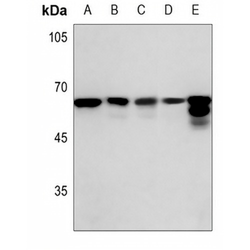 FYN Rabbit Polyclonal Antibody