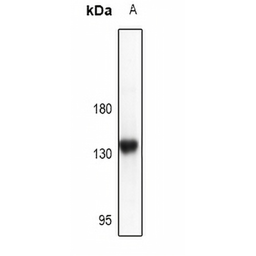 CD117 Rabbit Polyclonal Antibody