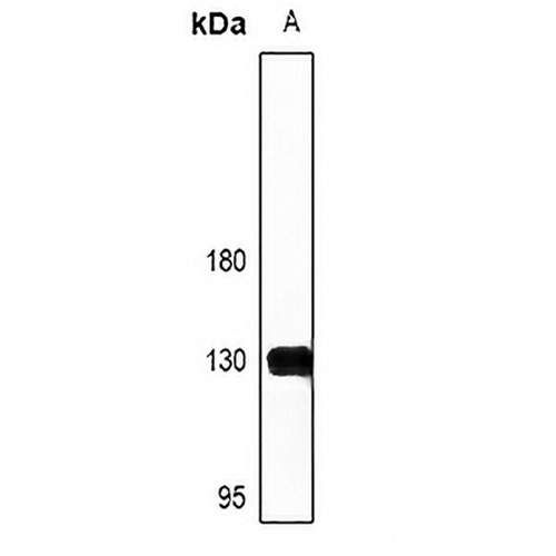 NFAT1 Rabbit Polyclonal Antibody