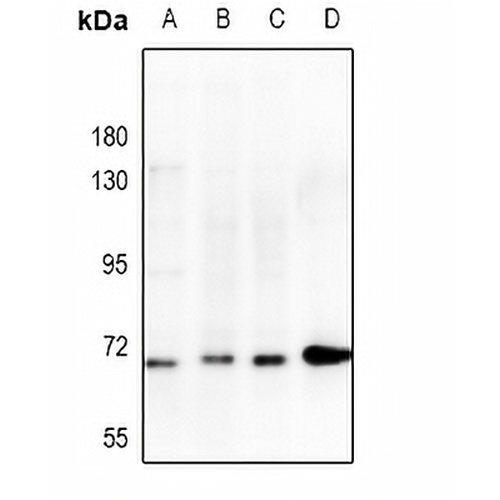CHK2 Rabbit Polyclonal Antibody