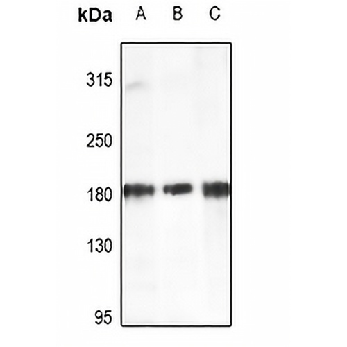 HER2 Rabbit Polyclonal Antibody