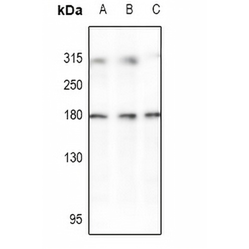 HER2 Rabbit Polyclonal Antibody