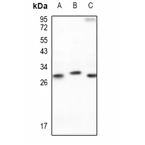p27 Kip1 Rabbit Polyclonal Antibody