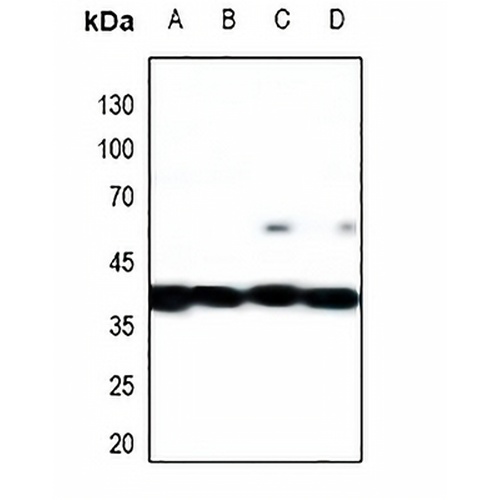 MKK1/2 Rabbit Polyclonal Antibody