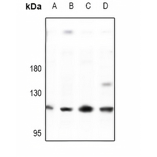 E Cadherin Rabbit Polyclonal Antibody