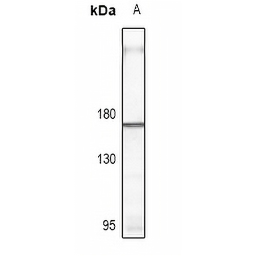 CD115 Rabbit Polyclonal Antibody