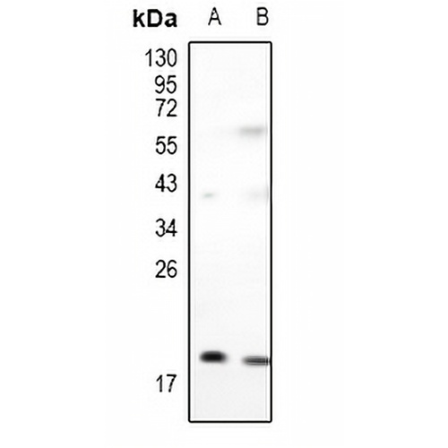 Adenylate Kinase 1 Rabbit Polyclonal Antibody