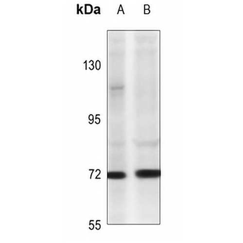 TNFAIP2 Rabbit Polyclonal Antibody