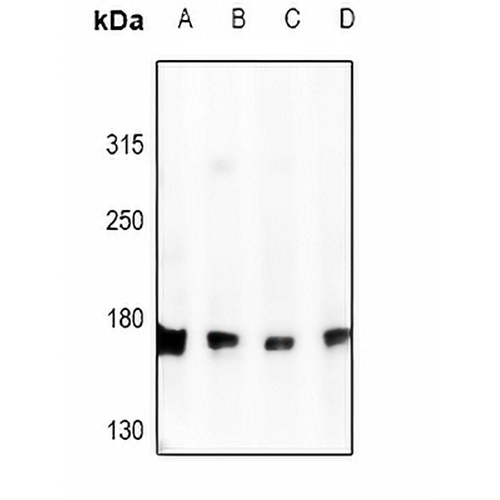 DLC1 Rabbit Polyclonal Antibody