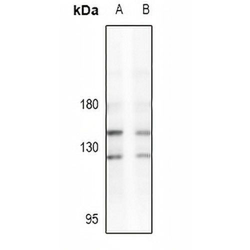 LATS2 Rabbit Polyclonal Antibody
