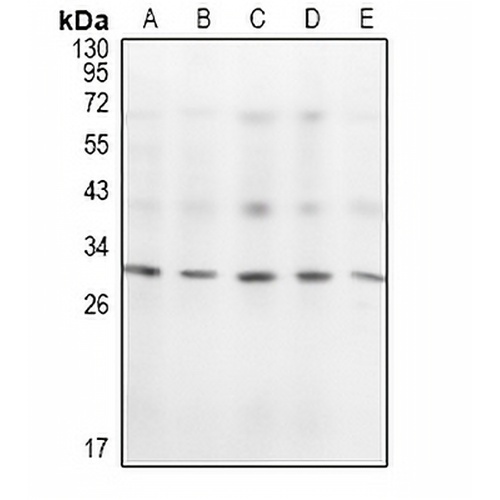 KCHIP1 Rabbit Polyclonal Antibody