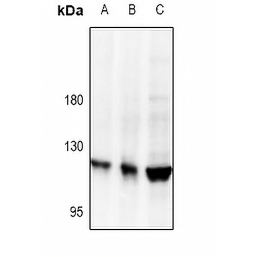Collagen 5 alpha 2 Rabbit Polyclonal Antibody