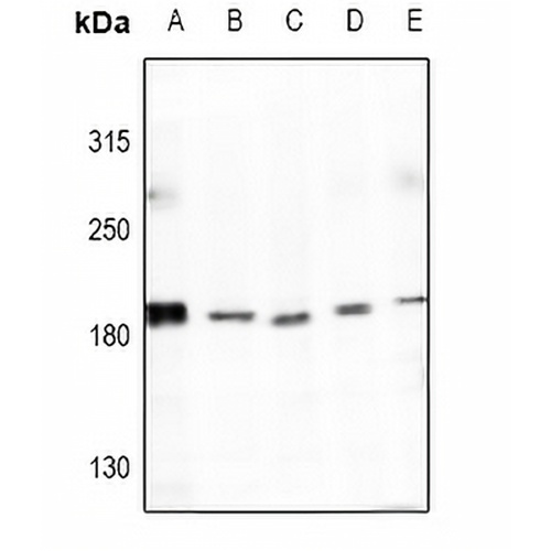 Collagen 4 alpha 4 Rabbit Polyclonal Antibody