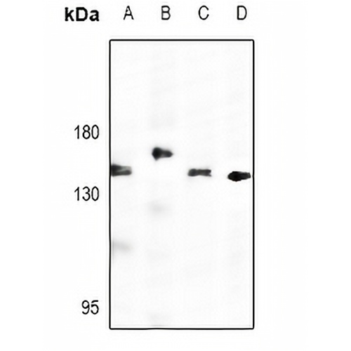 Adenylate Cyclase 7 Rabbit Polyclonal Antibody