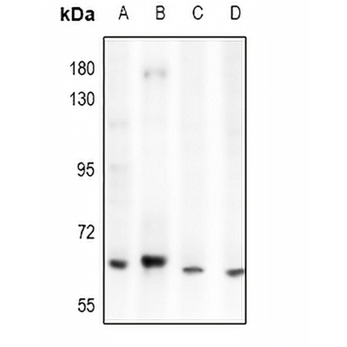 ACOT12 Rabbit Polyclonal Antibody