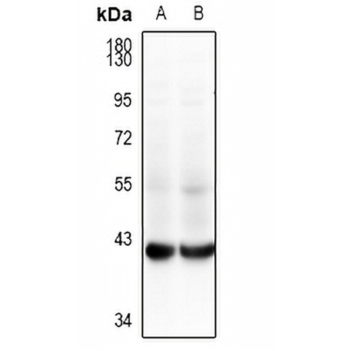 GALM Rabbit Polyclonal Antibody