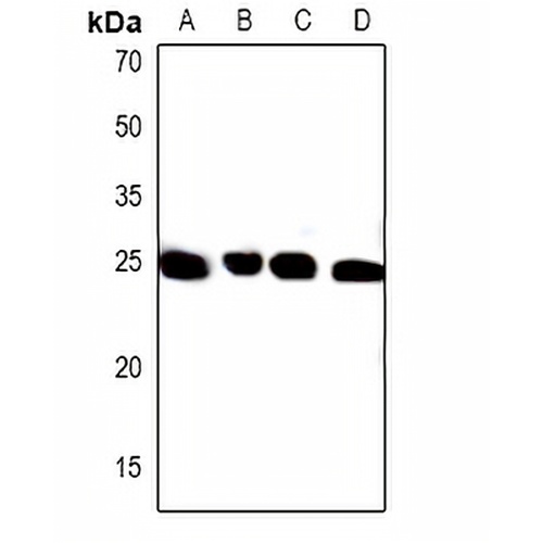 PXMP4 Rabbit Polyclonal Antibody