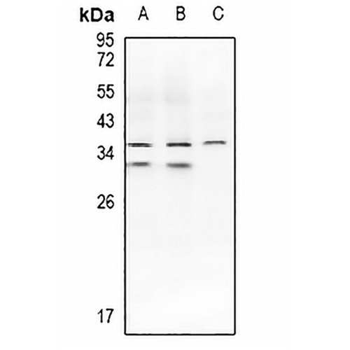 IL-1 beta Rabbit Polyclonal Antibody