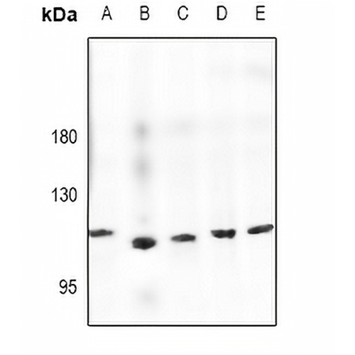 Semaphorin 6D Rabbit Polyclonal Antibody