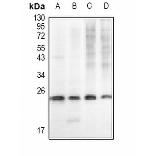 Cathepsin B Rabbit Polyclonal Antibody