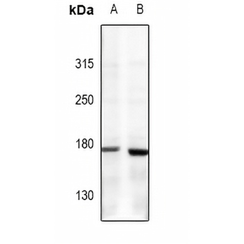 Collagen 5 alpha 1 Rabbit Polyclonal Antibody